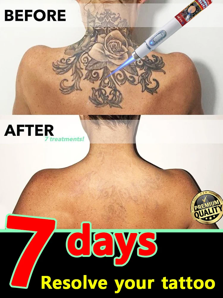 LáPiz Para Eliminar… - image