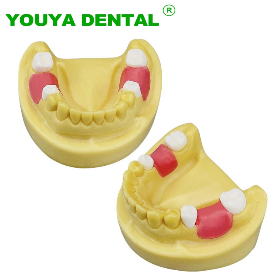 

Dental Teaching Teeth Model Mandibular Jaw Implant Practice Demo Typodont Training Display Dentistry Oral Demonstration Models