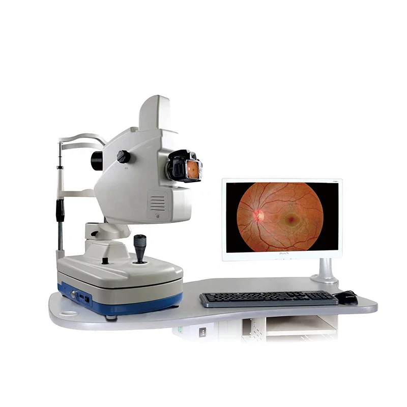 Ophthalmology Examination Equipment Desk Top Medical Non Mydriatic Digital Eye Fundus Camera