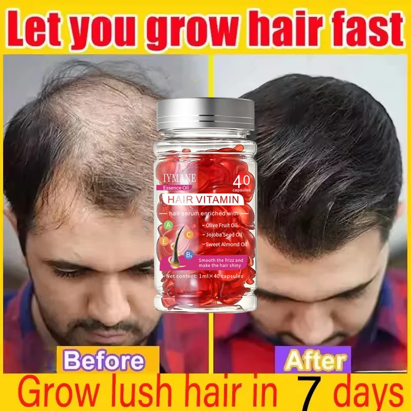 

Hair Growth Capsules 7 Days Fast Regrowth Essential Capsule Anti Hair loss Baldness Repair Damaged Scalp Treatment For Women Men