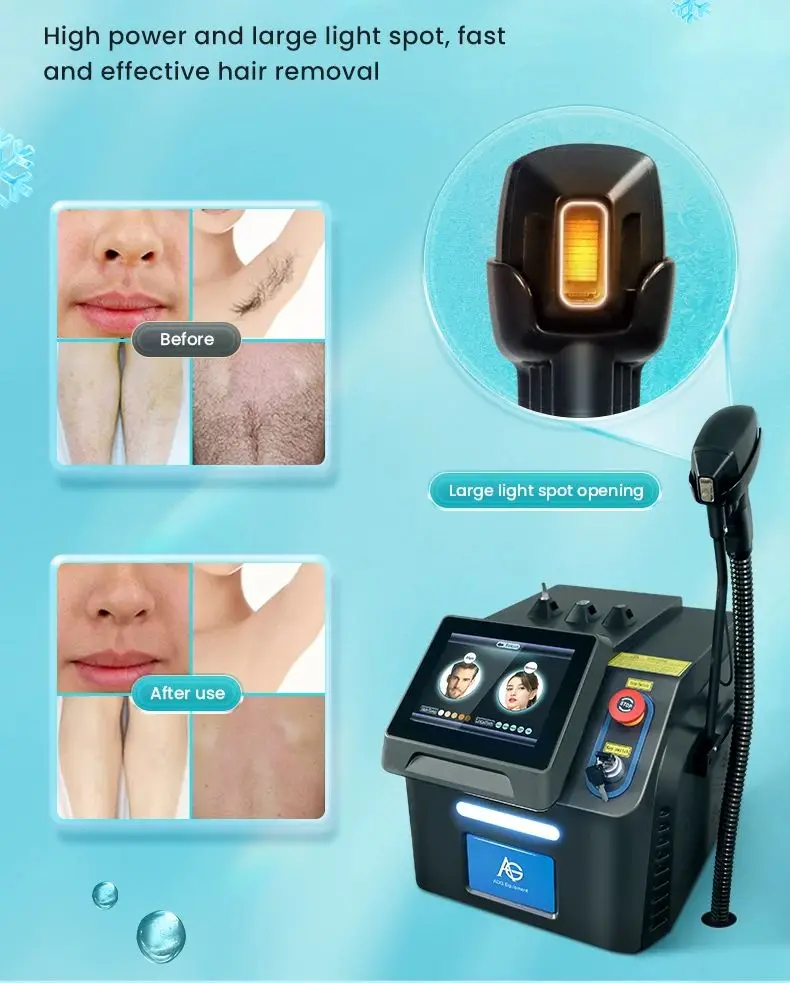 2024 Top Quality CE Approved Diode Laser Ice 755 808 1064 Diode Laser Hair Removal Machine Titanium Skin Rejuvenation Machine