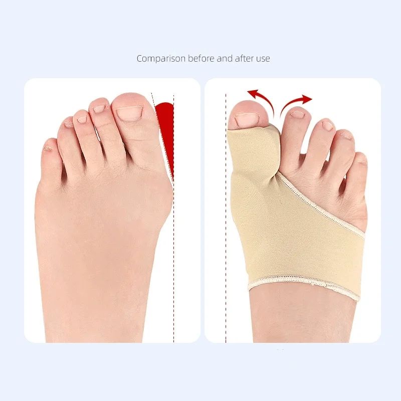 1/2Pair Bunion Corrector Toe Separator For Big Toe Relax Spread And Stretch For Hallux Valgus & Bunion Support Protector