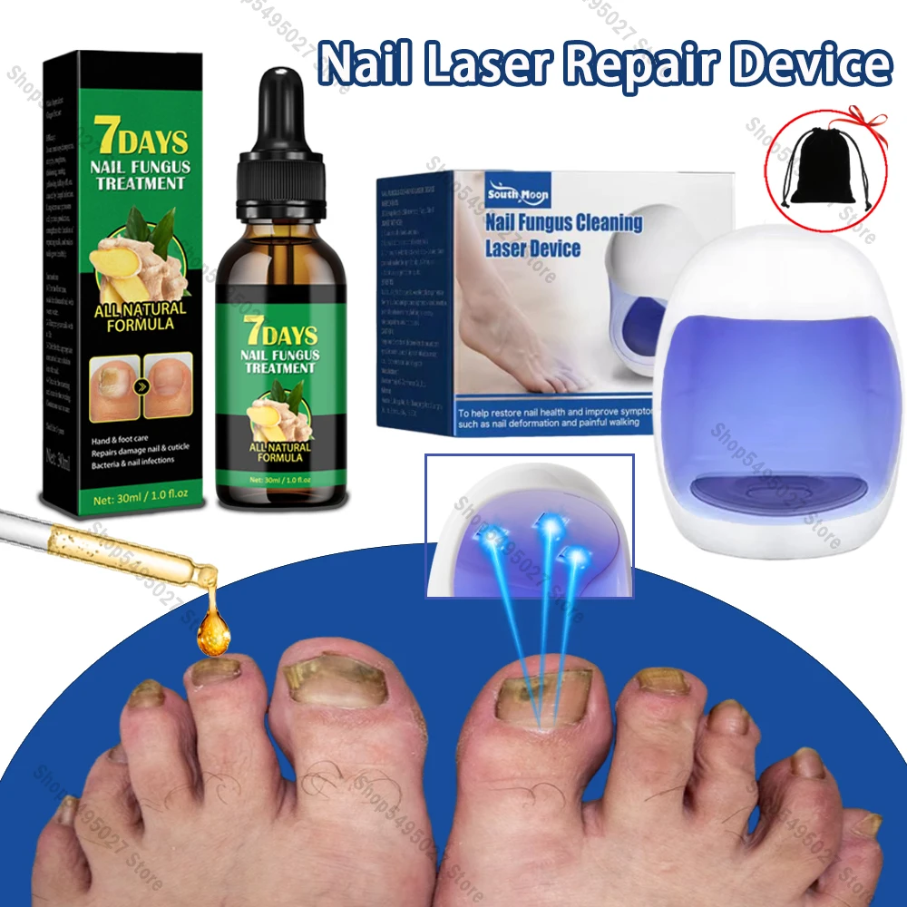 

Nail Fungus Laser Treatment Device Repair Toenail Fingernail Treat Toenail Nail Fungal Treatment Essential Oil Onychomycosis