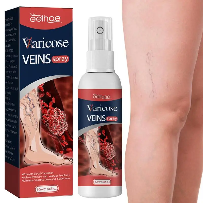 

30ml Varicose Vein Spray Vasculitis Phlebitis Relief Spray Spider Legs Earthworm Legs Treat Spray Swelling Discomfort Body Care