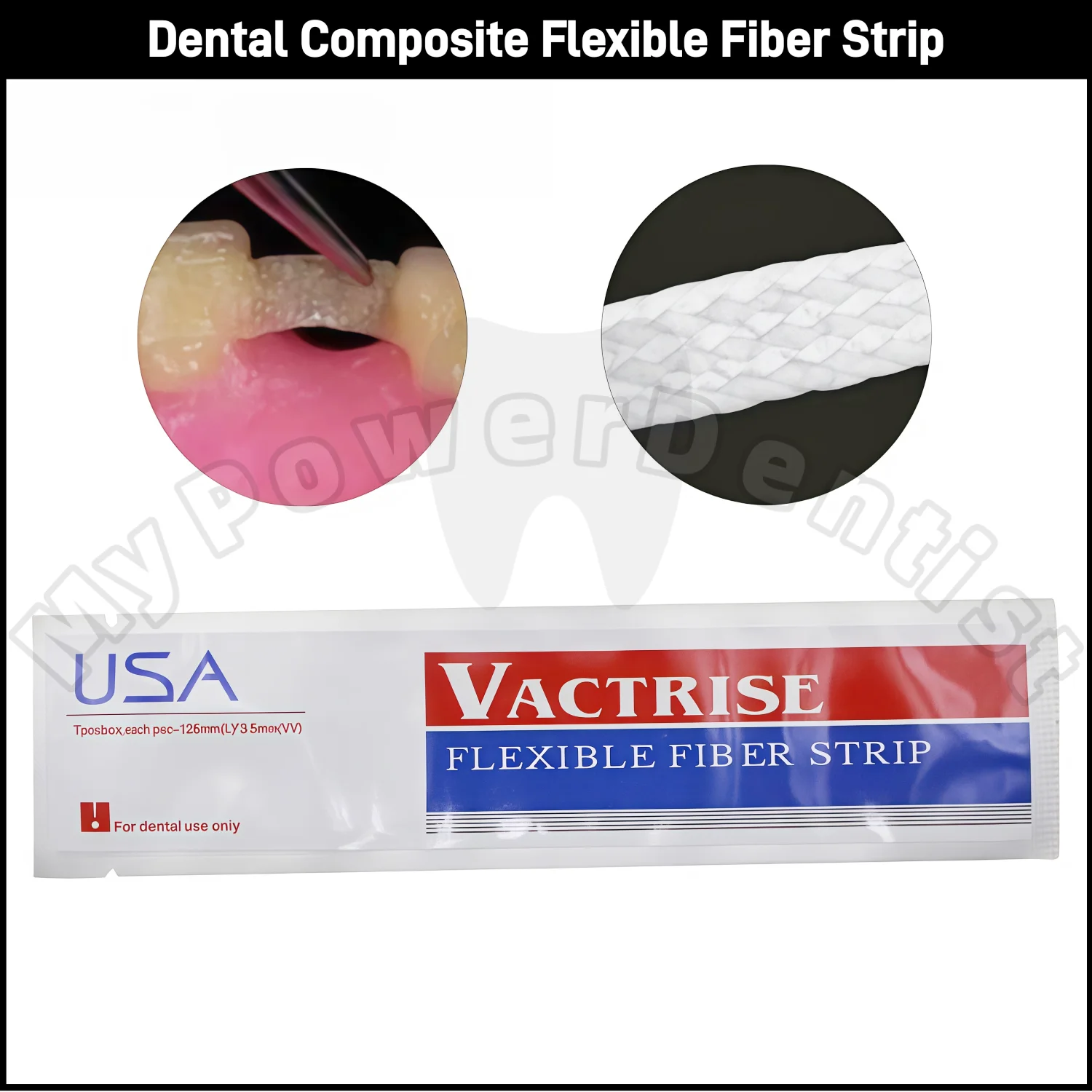 

Стоматологические фибровые полоски из стекловолокна, гибкие полоски для композитного пломбирования, 1-14 шт.