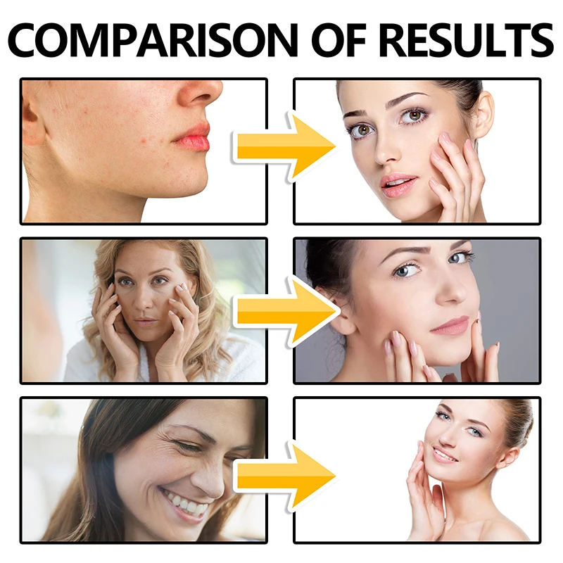 Blue Copper Peptide Wrinkle Serum Firming Lifting Reduce Lightens Fine Lines Moisturizes Transparent Fine Pore essence -30ml - Image 4