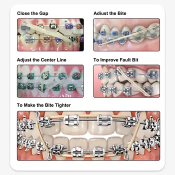 ELIJAH CYZ115 XYSZ 5000 ks/krabice O-kroužky/inter ústní gumičky zubní ortodontické zoo balení gumičky gumičky latexové ligatury úvazky 10 nejlepší prodej ligové pavouky - №3