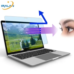 2PCS Eye Protection Screen Protector pour ordinateur portable 14 15.6 Macbook Air 13 A2337 A2681 M1 M2 Pro 16 