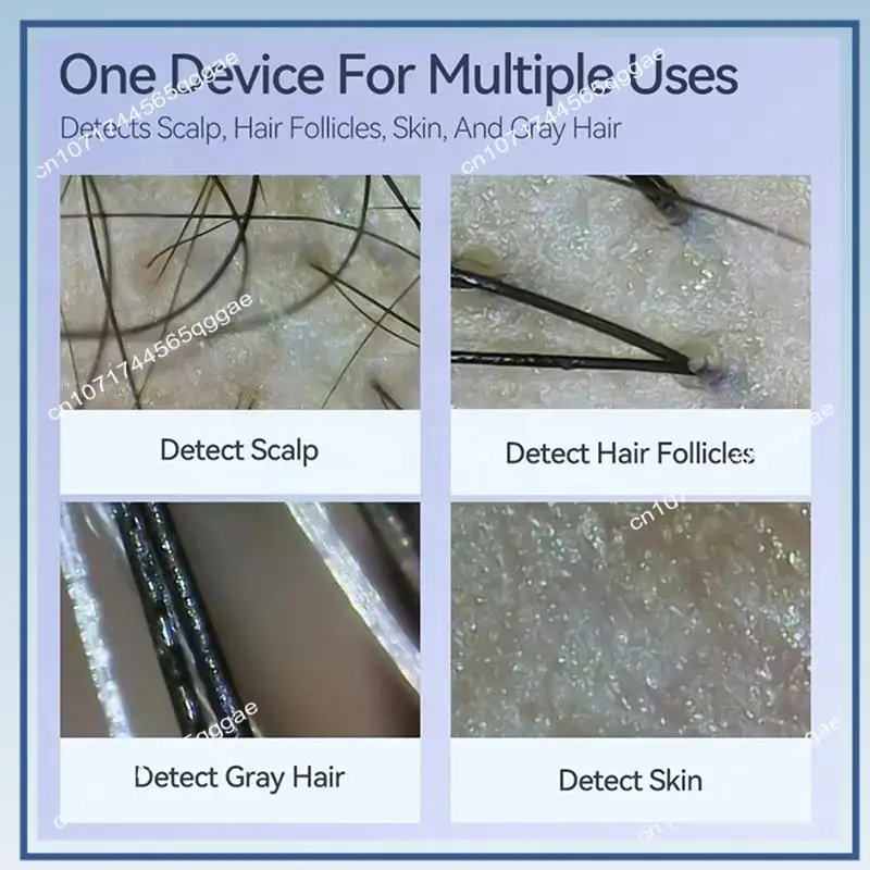 Dermatoscópio eletrônico profissional para análise de saúde da pele A67I - câmera digital para couro cabeludo e ferramenta de ampliação de poros