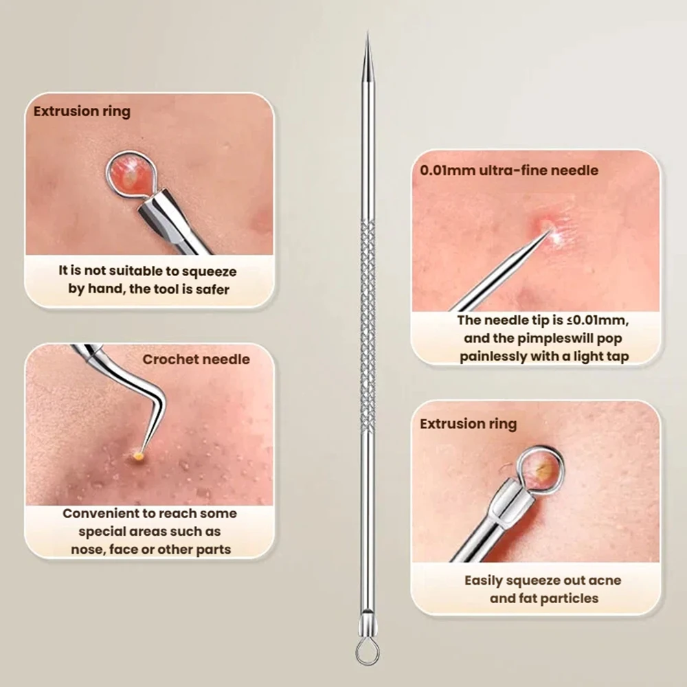 3 pçs/set clipe de acne de aço inoxidável, clipe de célula, clipe de cravo, agulha de acne, agulha de acne de salão de beleza, ferramenta de agulha de acne