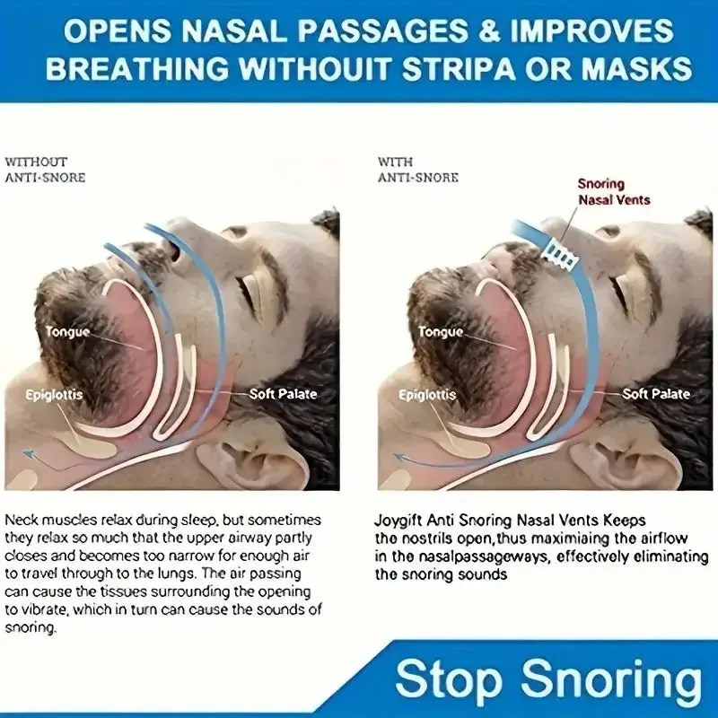 1pc Anti Snoring Nasal Dilator for Easy Breathing Cones Congestion Aid Sleeping Aid Equipment Stop Snoring Nasal Dilators