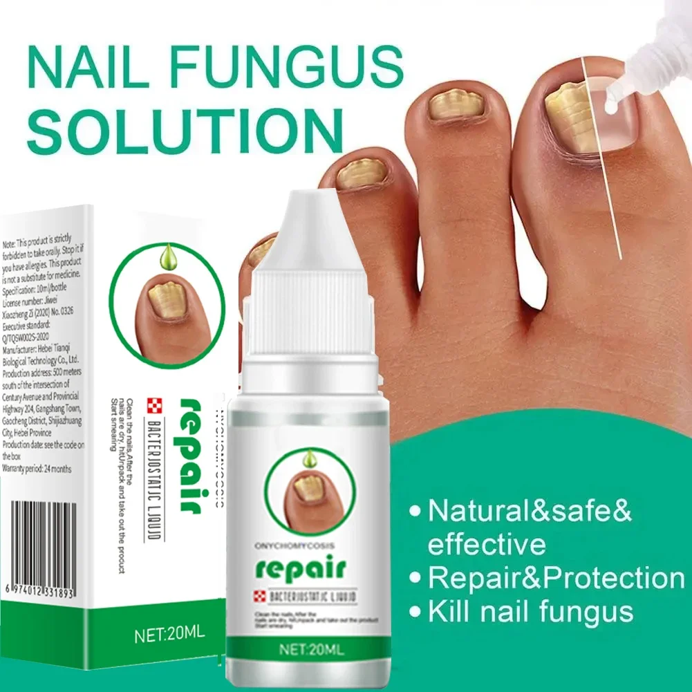 

7 Days Nail Fungus Treatment Fungal Treatment Feet Care Essence Anti Infection Paronychia Onychomycosis Ingrown Toenail