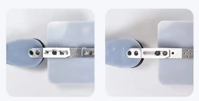 Elastyczny gorset korekcyjny dla dzieci i dorosłych z wadą żebra i żebra.