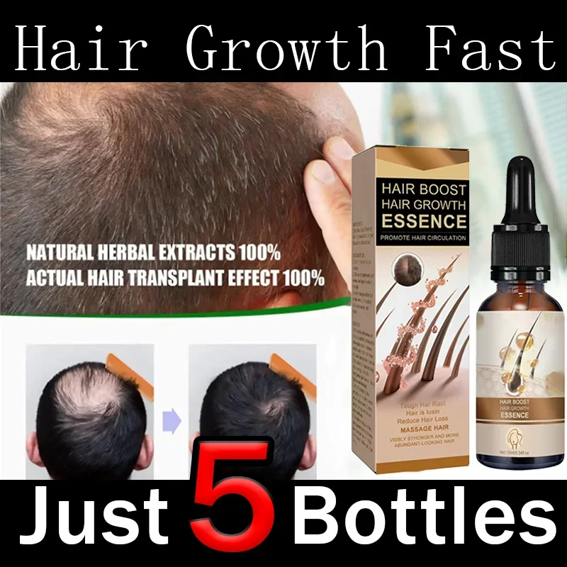 Hair Growth for Men Women Fast Growing Products Essential Oils Ginger Anti Hair Loss Scalp Treatment Hair Care