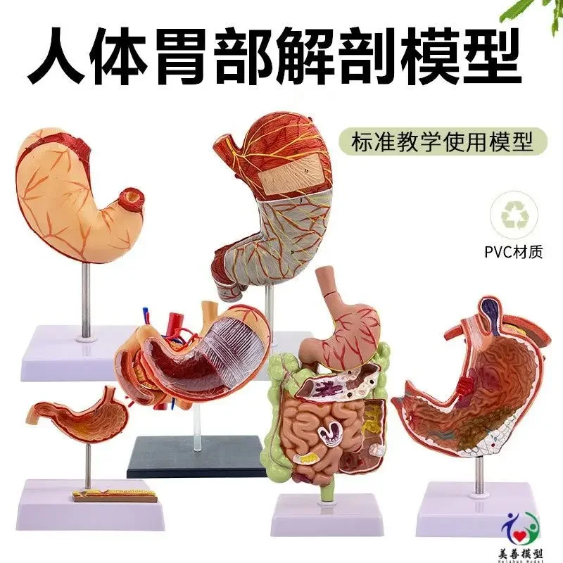 Pathological Stomach Model, Perforation Of Human Stomach Pathological Stomach Model Gastroenterology, Coronal Section Of The Gas
