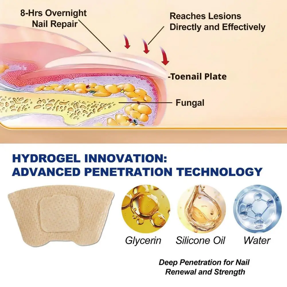 32개입 곰팡이 손톱 패치, 발톱 곰팡이 치료용 강력 – 손상되고 변색된 손톱을 위한 밤새 손톱 관리 및 복구