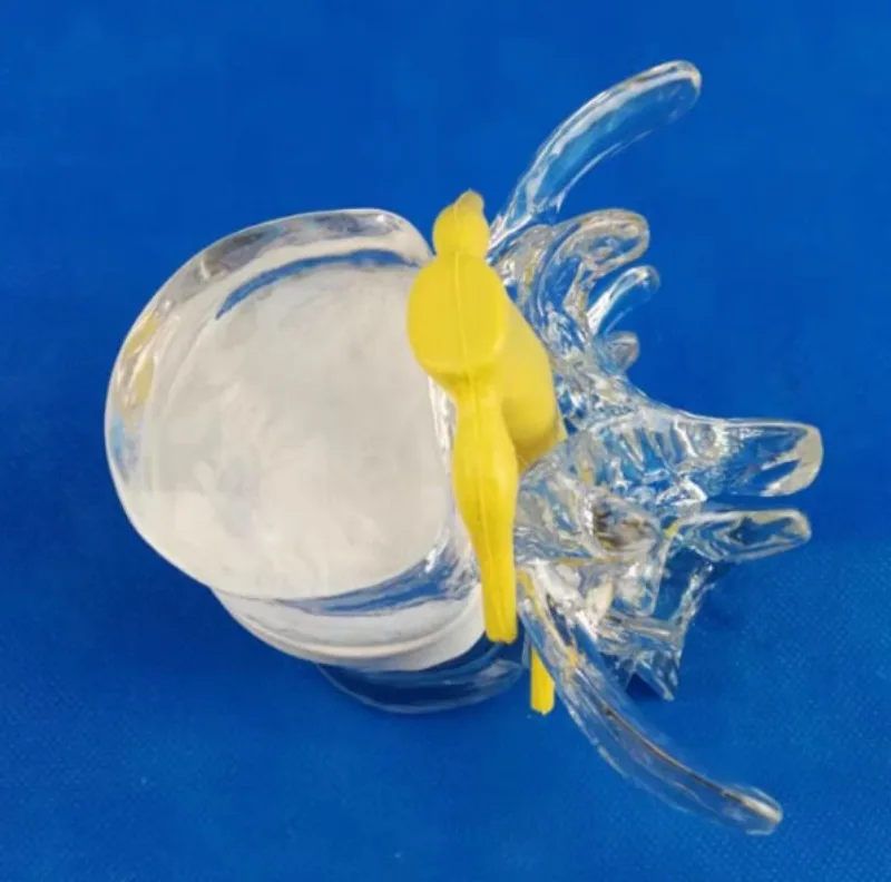

Spine and spinal cord extrusion demonstration model Human medical teaching model Spinal cord bubble ball