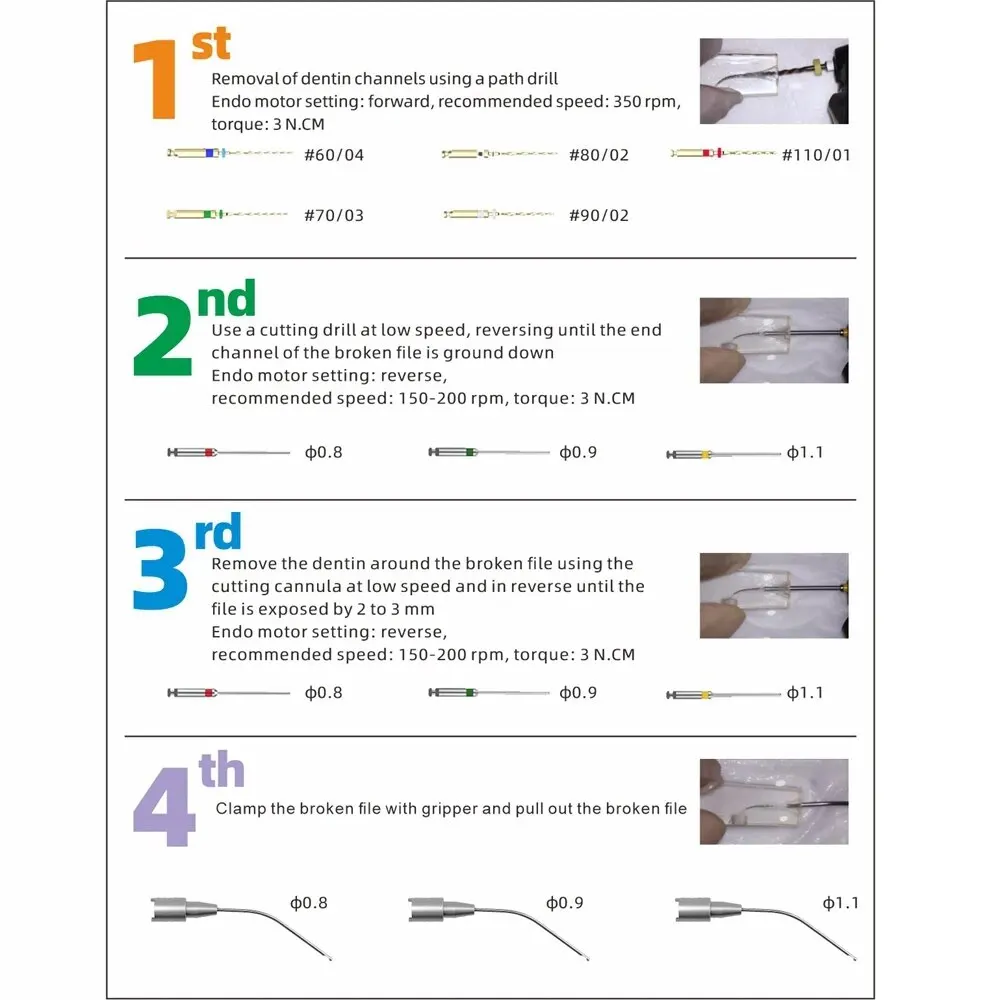 Ekstraktor pilników do kanałów korzeniowych złamany przyrząd do usuwania pilników ortodontycznych urządzenie do usuwania pilników Endo produkty