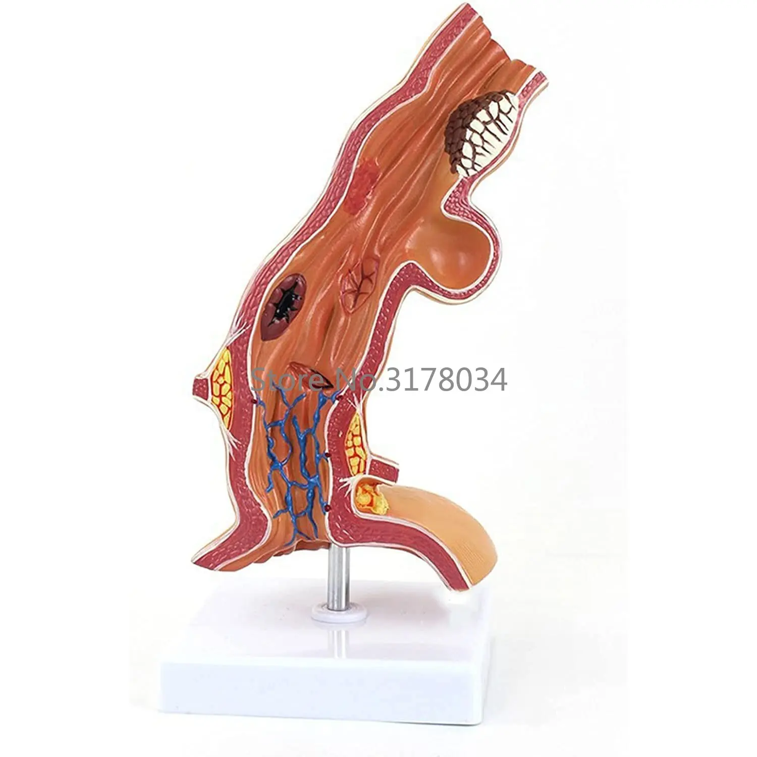 Human Esophagus Anatomical Model Medical Anatomical Department of Esophagus and Digestive Model for Medical Educational