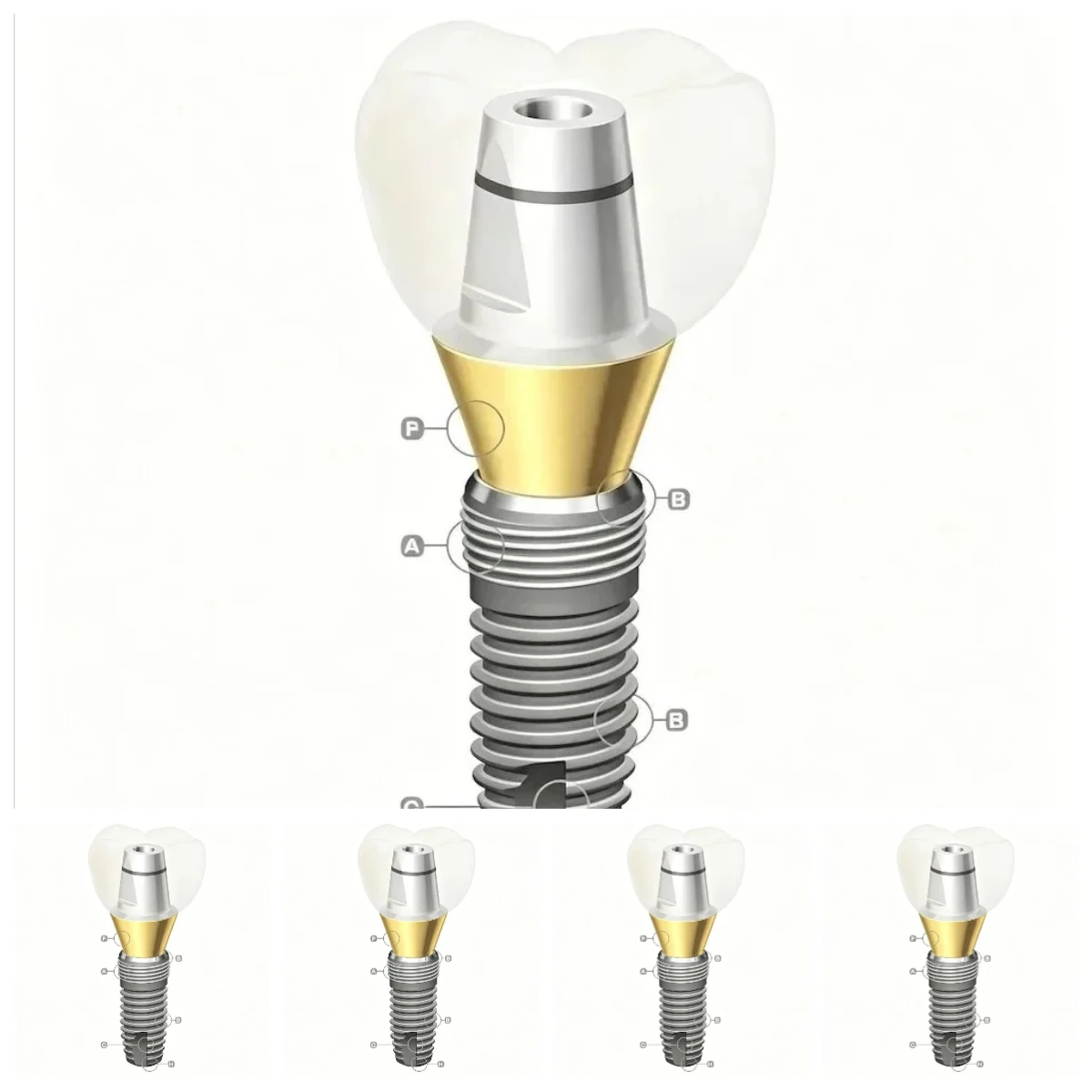 Premium Dental Implant Accessories Implant Screw Implant Analog Full Sizes Restoration Supplies