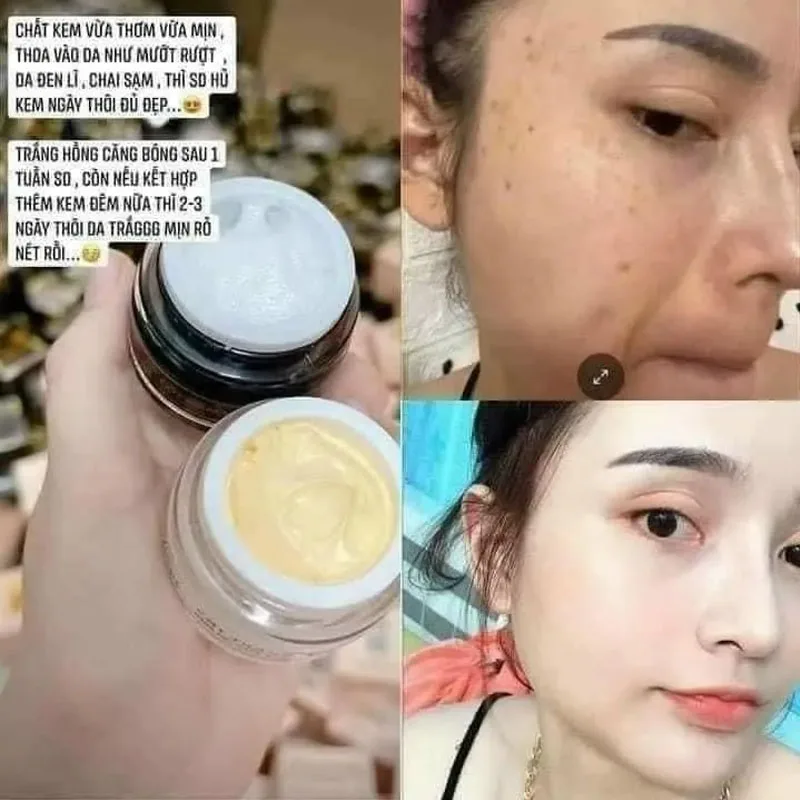 Combo 2 Hộp Kem Face cát náng Y NICs Thanh Nhi 10gr + Kem Cốt trng ng náng cơ Nicos Beauty 10gr