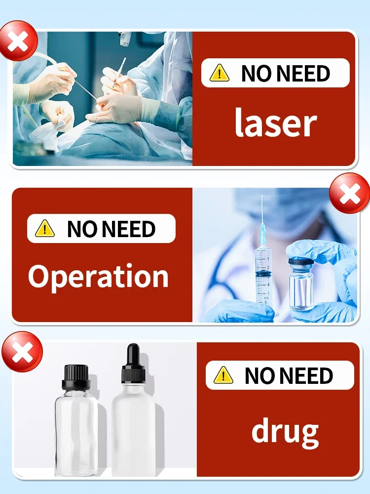 色素沈着アートメイクタトゥー除去タトゥースプレークイック除去