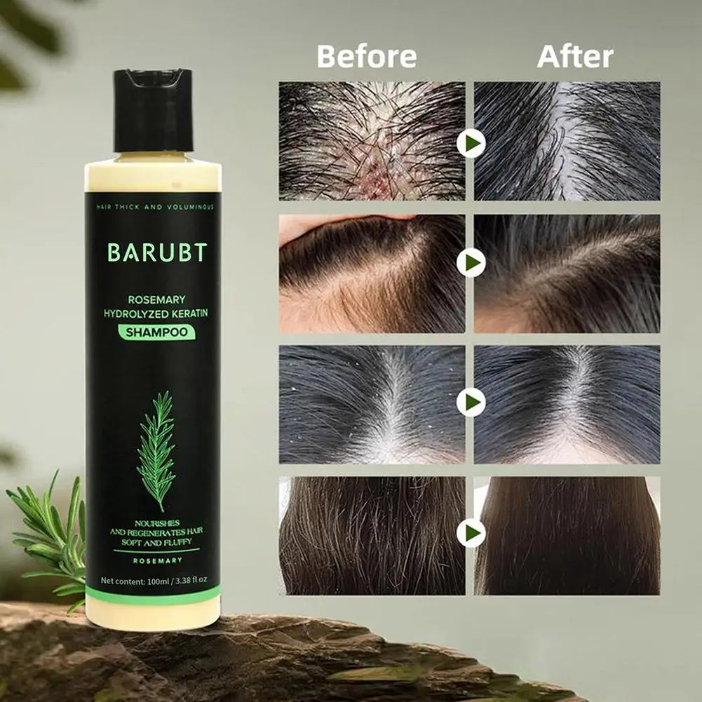 Rosemary Shampoo Hair Growth Deep Cleansing Scalp Anti Dandruff Oil Control Strengthening Root Nourish Hair Volumizing Shampoo view 4