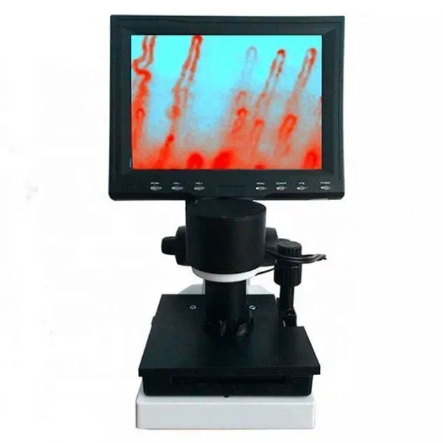 Nail Fold Microcirculation Blood Capillary Microscope