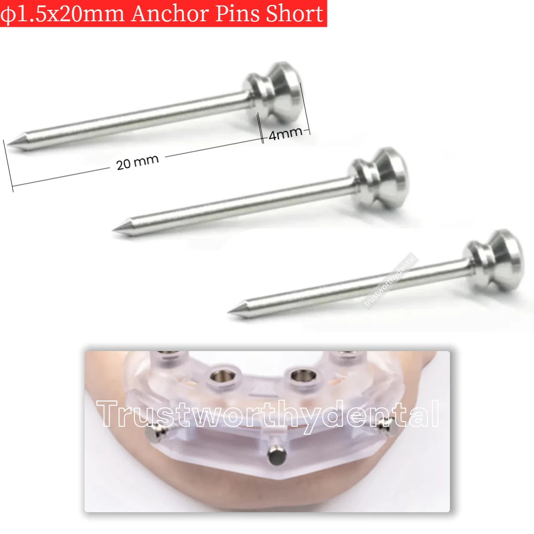 

Φ1,5x20 Стоматологический направляющий якорный штифт с коротким валом, управляемый фиксирующий штифт для имплантатов, комплект фиксирующих штифтов для шаблонов, подходит для NobelGuide