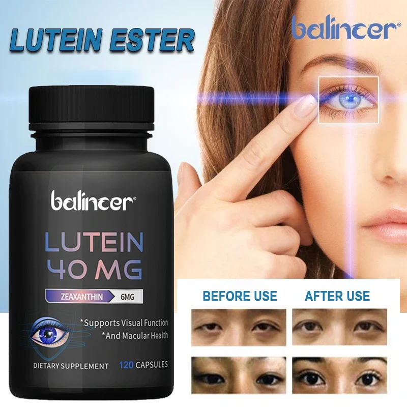 Advanced Eye Lutein Supplement for Macular Health and Dry Eyes - Lutein, Zeaxanthin - Supports Eye Fatigue, Stress, Night Vision