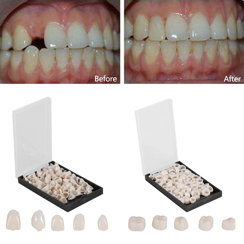 50Pcs Front Back Dental Crowns Resin Helping Fix Realistic Temporary Teeth Crown Stable Teeth Whitening Molar Beautify Oral Care