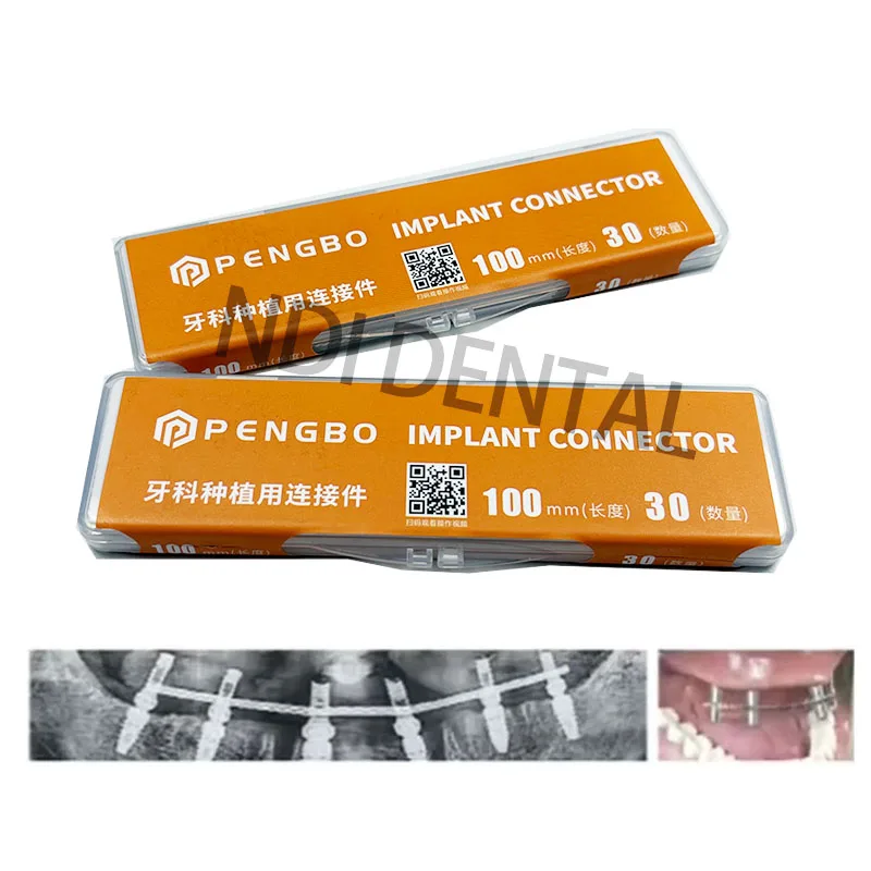Dental Implant Connector Stainless Wire 10/20/30Pcs for Overdenture MU Impant Wire can be Welded or Bonded MU Wires Strengthener