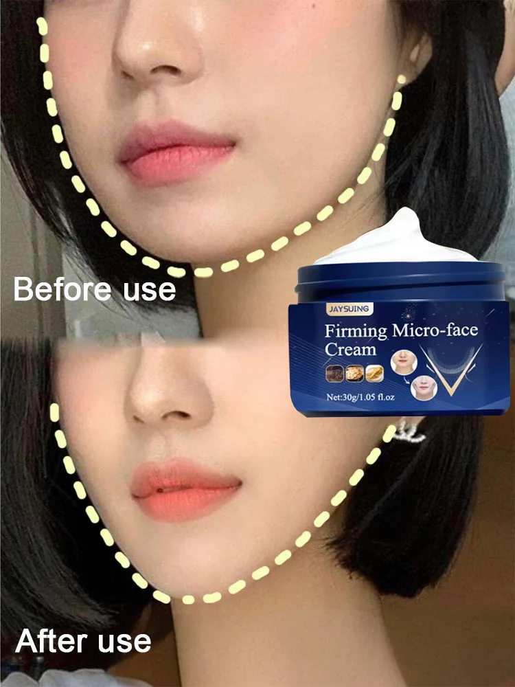 

V-Shape Slimming Cream Firm Face-lift Removal Double Chin Eliminate Masseter Muscle Tighten Two-Mandibular Line Anti-aging Cream