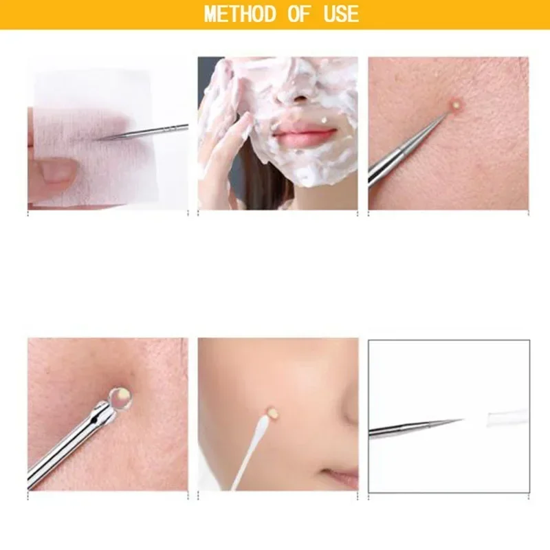 4pcs/set Blackhead Remover Acne Blackhead Vacuum Comedone Blemish Extractor Pimple Needles Removal Tool Spoon For Face