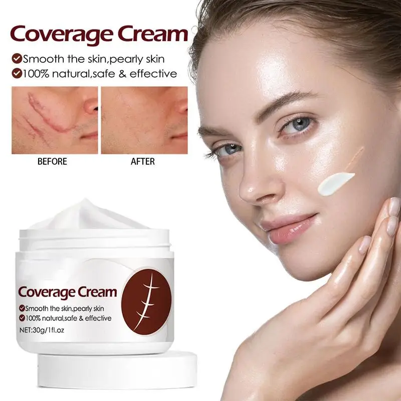 Crema Corporal protectora anticicatrices, Gel portátil para eliminar cicatrices naturales, 30g