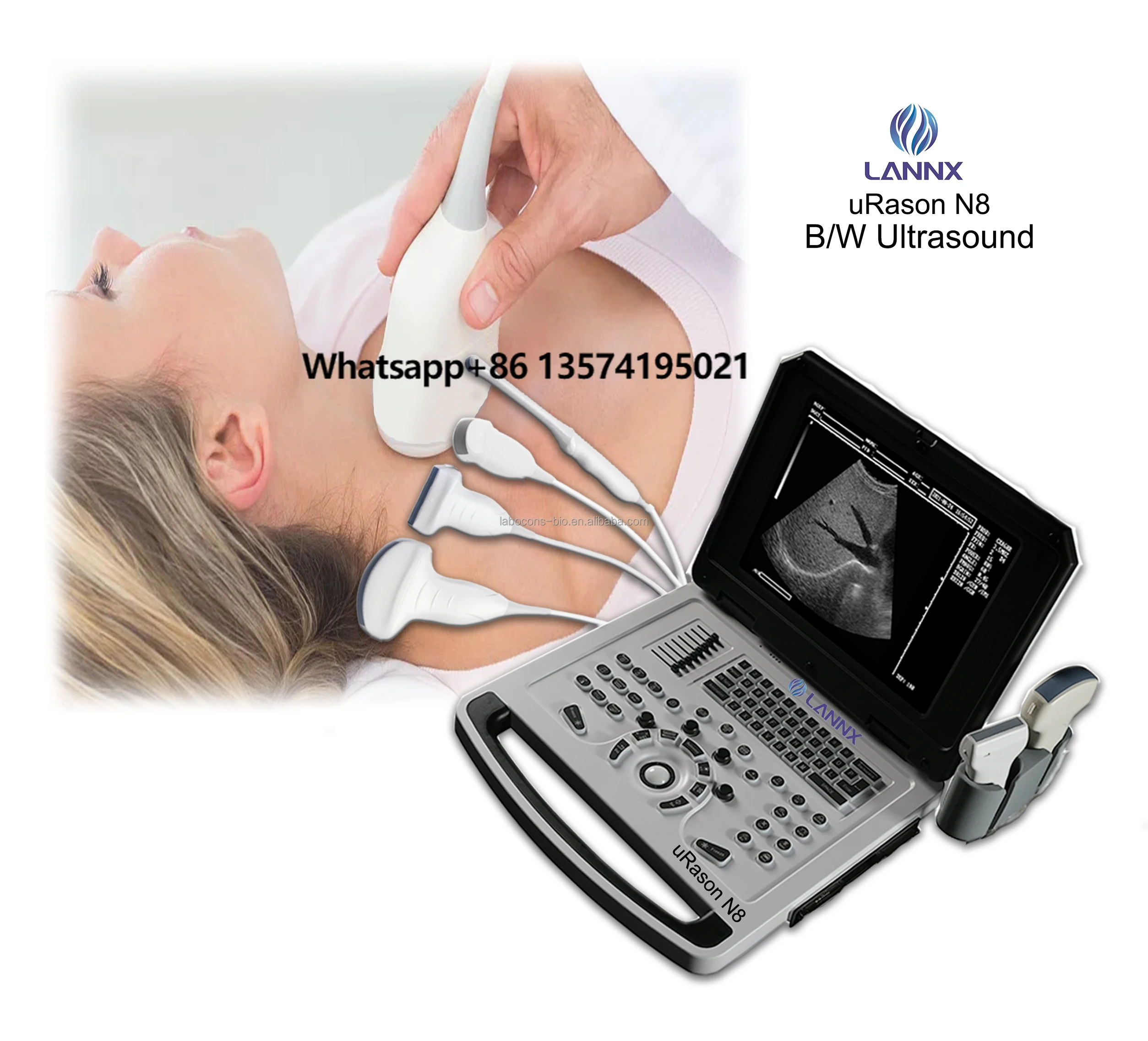 LANNX URason N8 High Quality Cardiac OB GYN Echocardiography Ultrasound Machine Portable Ultrasonic Scanner Laptop Ecografo