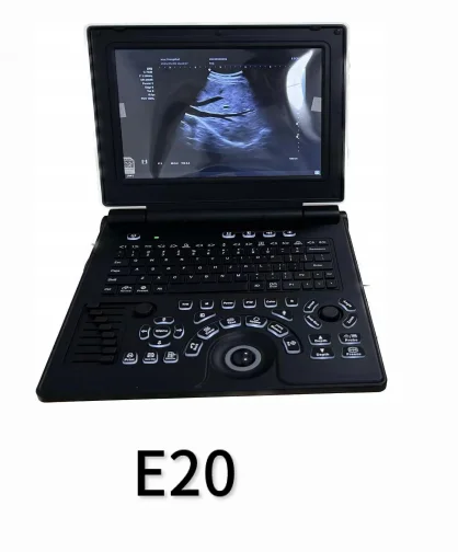 Portable color ultrasound E20 with abdominal convex array probe