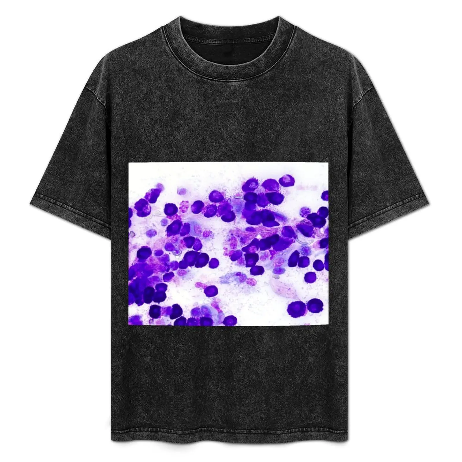 Mast cell tumor (MCT) T-Shirt sports fans anime clothes street wear men clothings