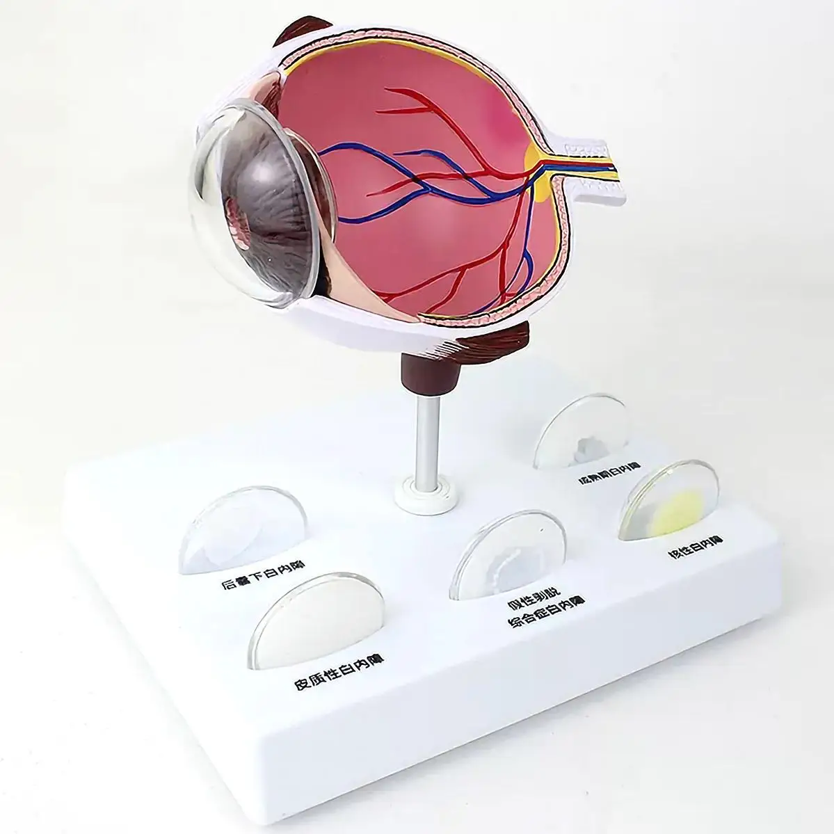 Human Cataract Magnification Eye Internal Anatomy Model Medical School