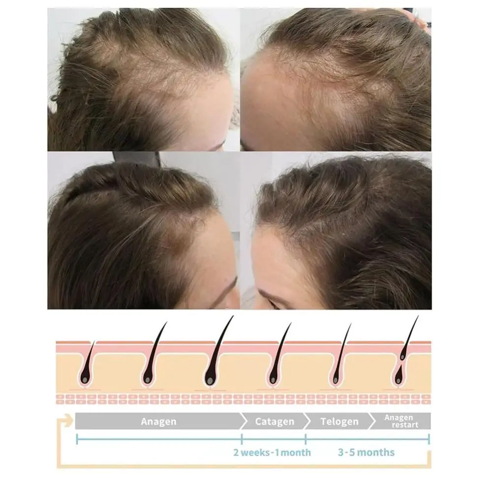 Nuovo Nutre le radici dei capelli Pacchetto pettine vortice Ad alta frequenza 4 impostazioni Macchina per il viso Bacchetta per la crescita dei capelli vortice facile da usare