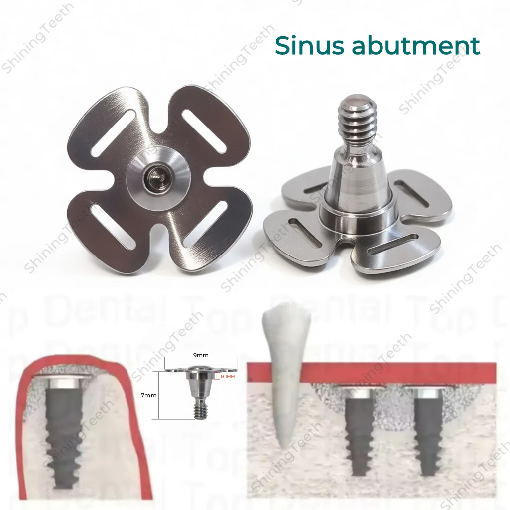 

Стоматологические аксессуары: Временные абатменты для синус-лифтинга, широкая основа, титановый винт, совместим с OSS 4-Leaf Clover