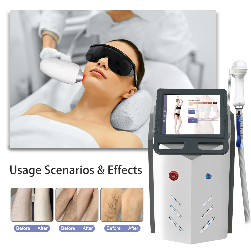Permanent Ice Platinum Laser Hair Removal Machine 3 Wavelength 808nm 755nm 1064nm Painless Diode Hair Removal Device