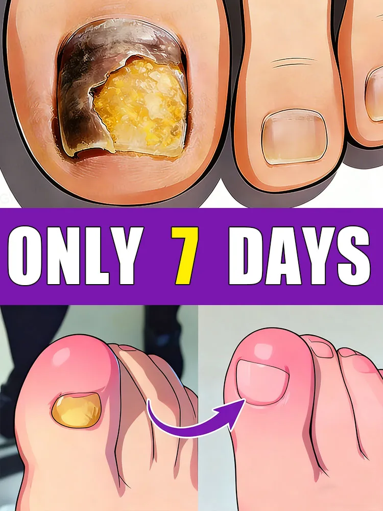 

Снижайте уровень тревоги и попрощайтесь с проблемами с ногтями. Пользуется широким признанием и пользуется огромной популярностью.