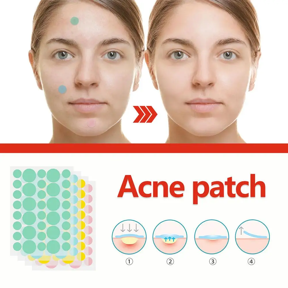 Patches hidrocolóides para remoção de acne, remoção invisível, espinha, manchas, marcas, corretivo, adesivo de reparo, impermeável, 144pcs