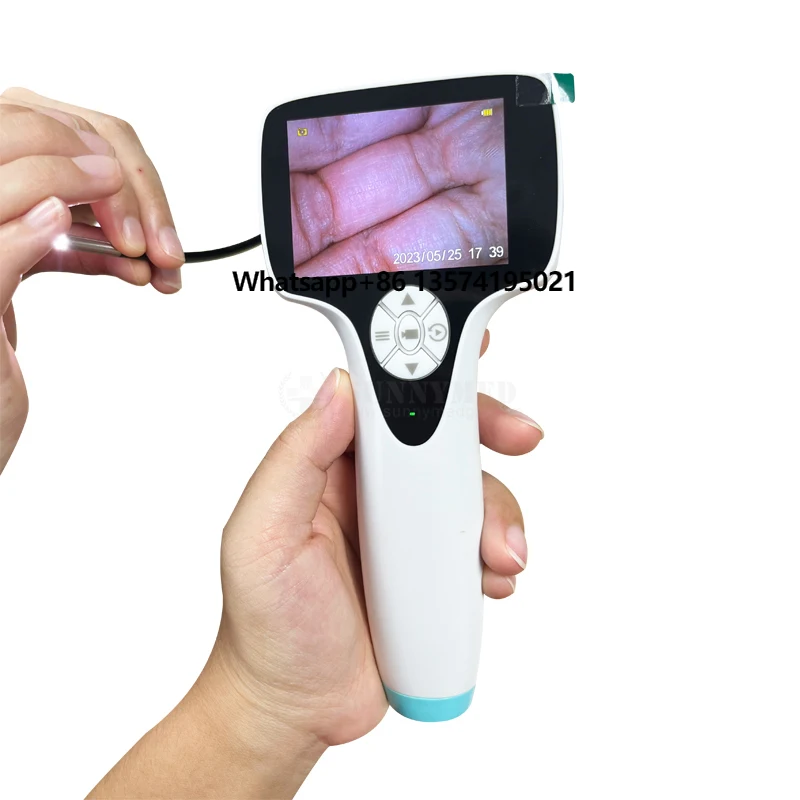 SY-G046-2 ENT Examination Wireless Video Digital Otoscope Handheld Rigid Endoscope Five Different Scopes