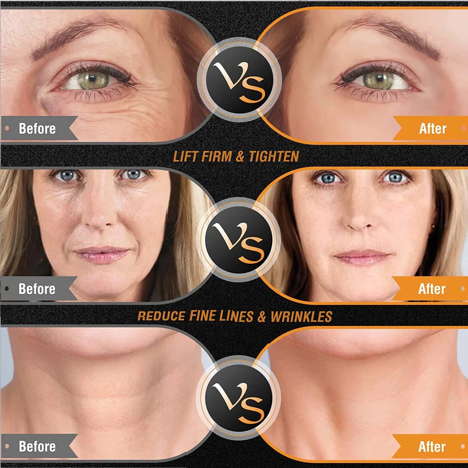 جهاز شد الجلد بتردد لاسلكي ، جهاز EMS ثنائي القطب والترددات اللاسلكية ، شد الوجه المترهل ، تشكيل الجسم ، إزالة تجاعيد العين ، مدلك ، الوجه #5