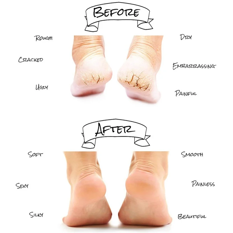 1 paar Voetsokken Hakken Zachte Voeten SPA Anti-Drogen Anti-Crack Hydraterende Gel Sok Voeden Huid Gereedschap