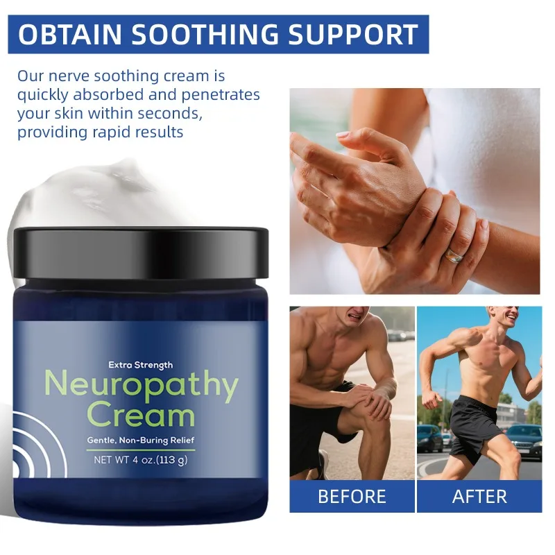 

Базовый крем для облегчения невропатии Vigor Migrastil, успокаивающий бальзам для облегчения невропатического дискомфорта