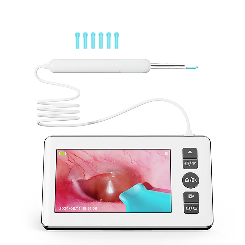 Digitales Otoskop mit 4,3-Zoll-HD-Bildschirm, Ohrenschmalz-Entfernungswerkzeug-Set mit Kamera, 3,9-mm-Ohrkamera für Erwachsene und Kinder