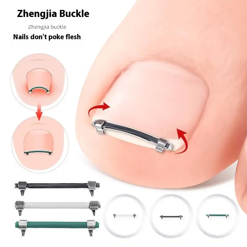 Ingrown Toenail Pedicure Tool Embed Toe Nail Care Straightening Correction Clip Curved Clamp Toenails Correction Tool For Toes
